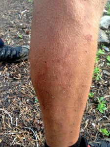 A PCT leg under assault